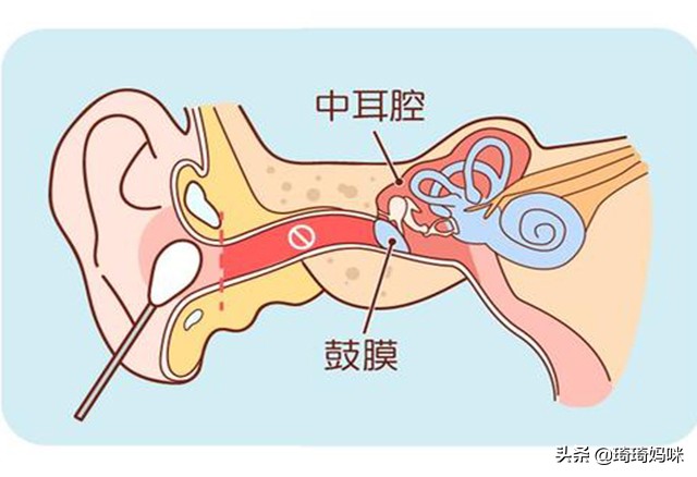 宝宝为什么会中耳炎,宝宝中耳炎是什么原因引起