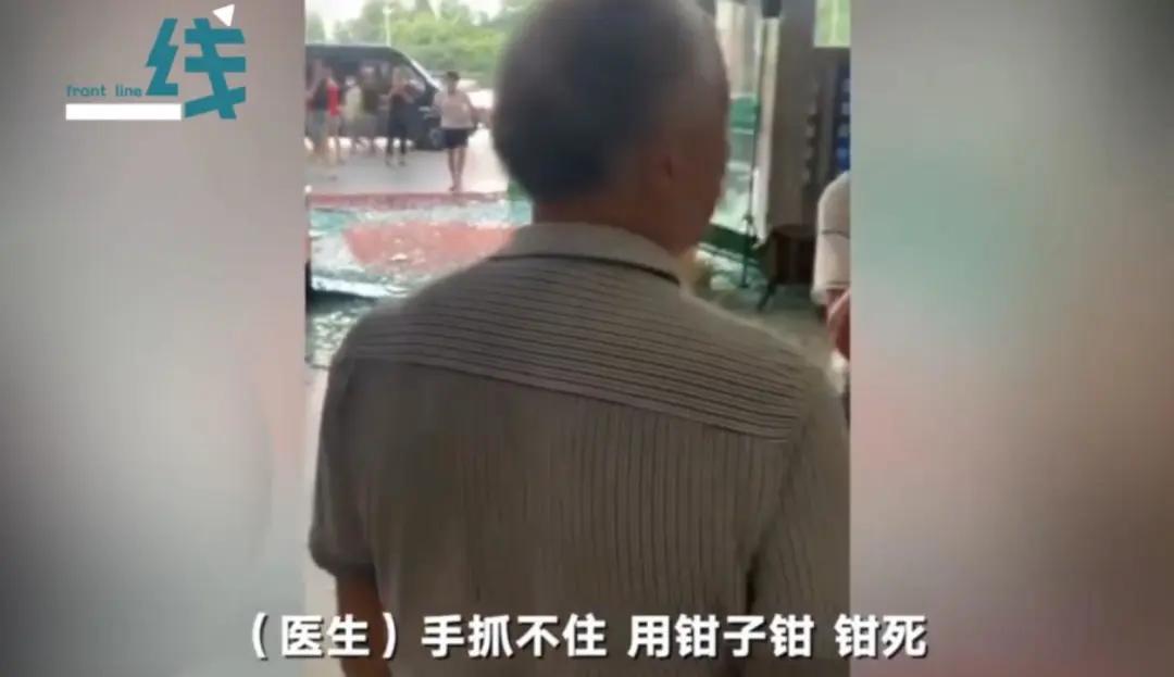 产钳夹出孩子,产钳夹过的孩子的图片