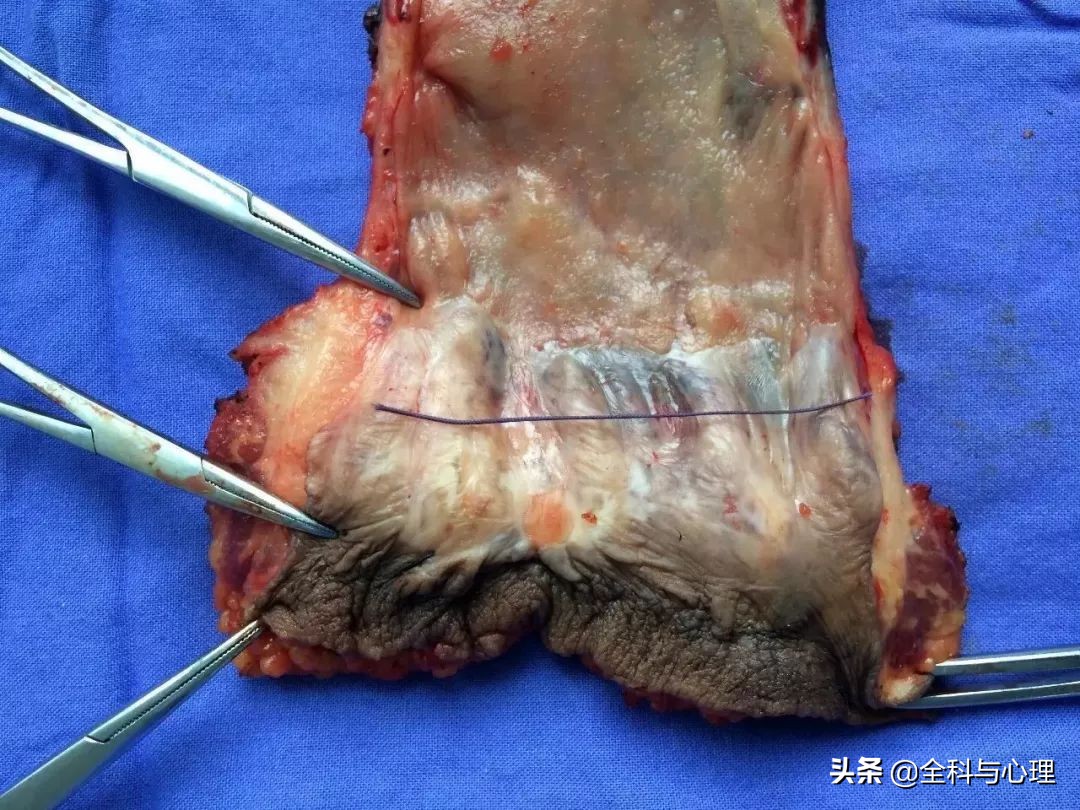 肛门有肿块是什么症状,肛门有哪些病变会痒