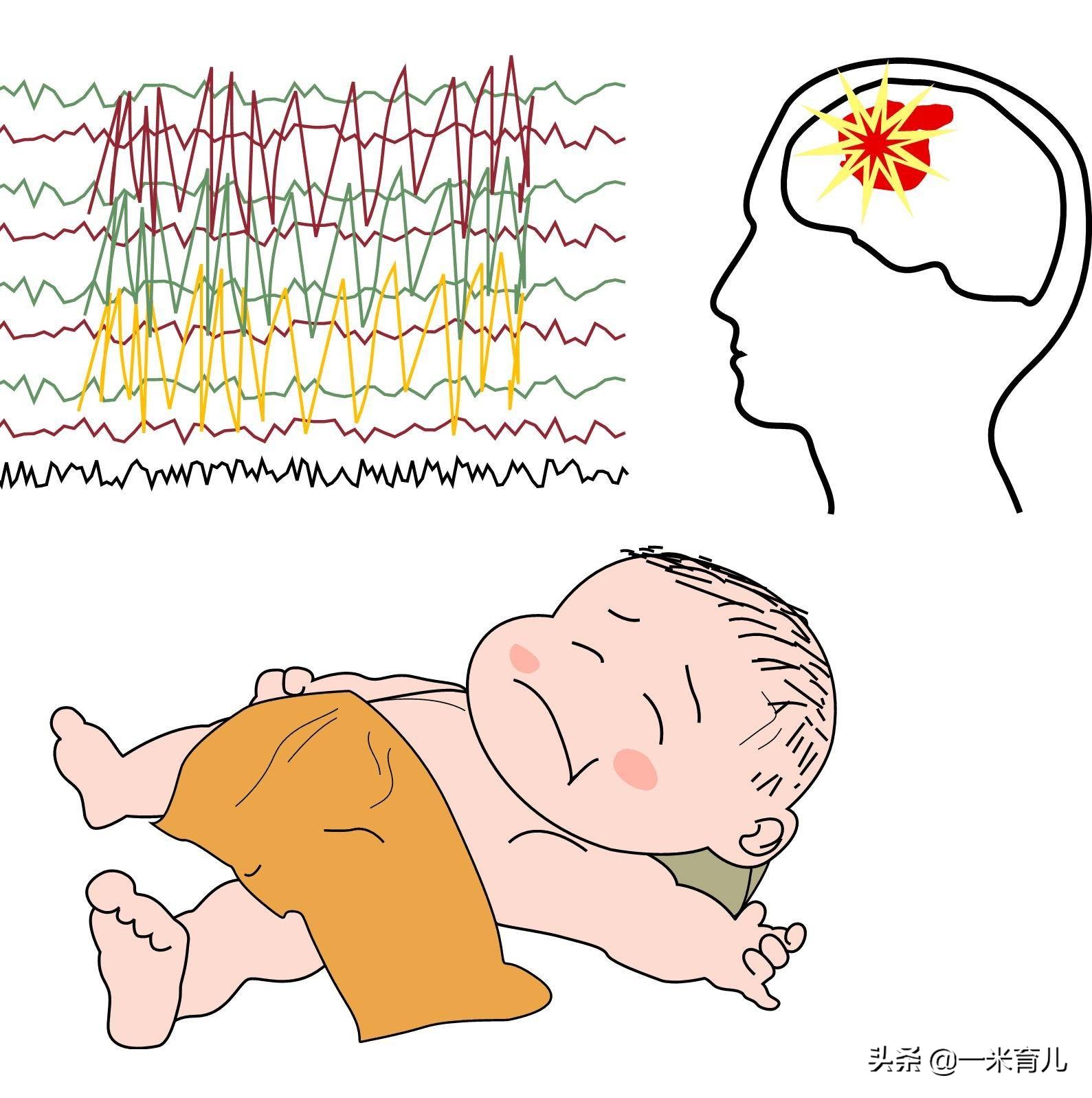 小儿癫痫莫要怕，规律服药、做好居家护理8要点，成长上学两不误