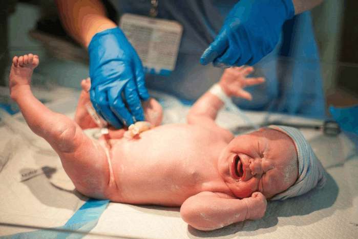 40周见红了脐带绕颈3圈能顺产吗,怀孕39周脐带绕颈3圈可以顺产吗