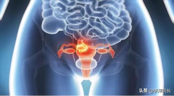 打了绒促针,卵泡还是不排,会是什么原因导致的