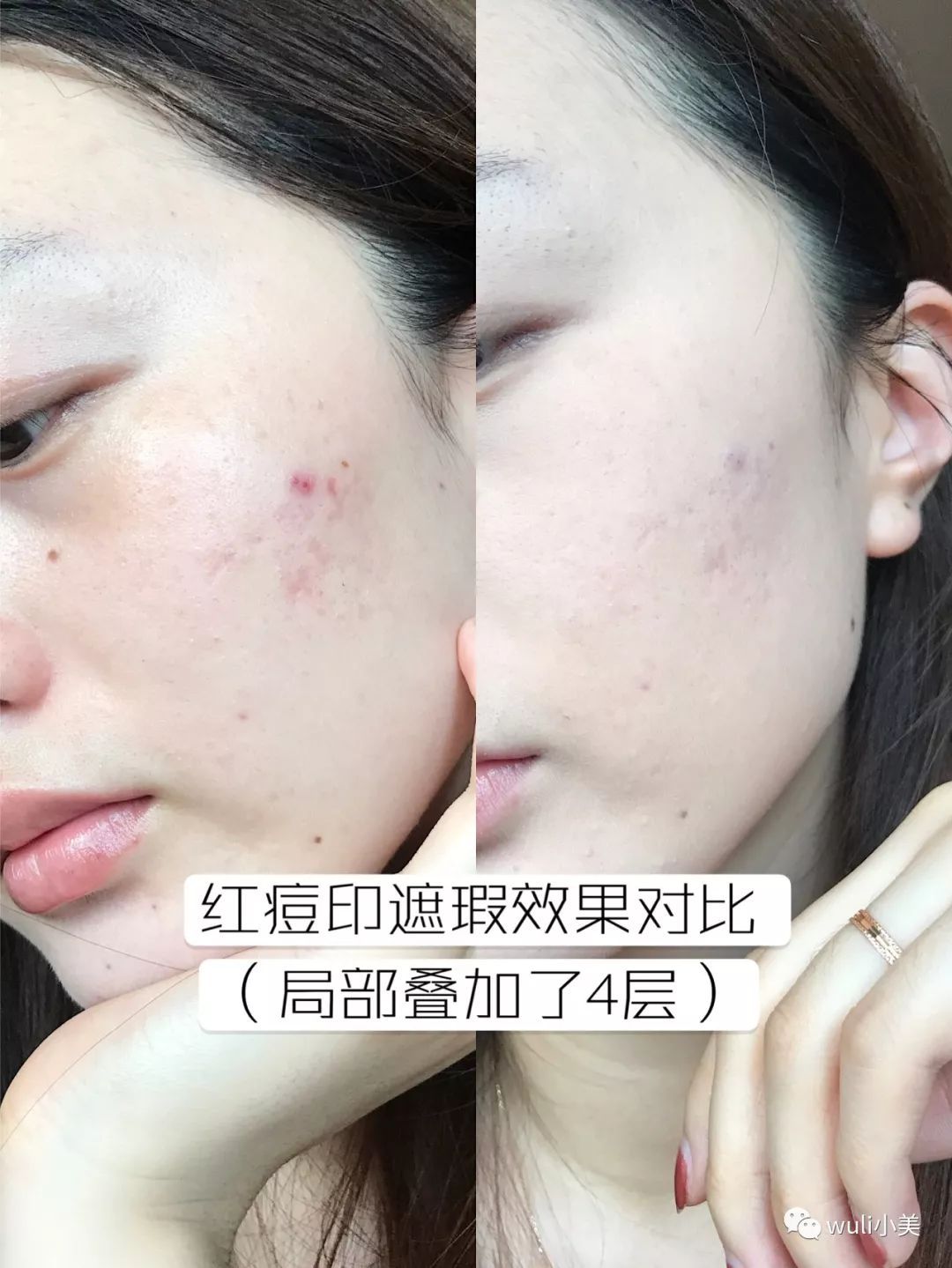 makeupforever适合白皮的粉饼,makeupforever粉底适合干皮