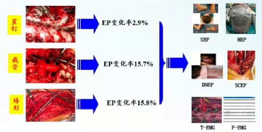 成人脊柱畸形矫形策略是什么,脊柱畸形医疗救治