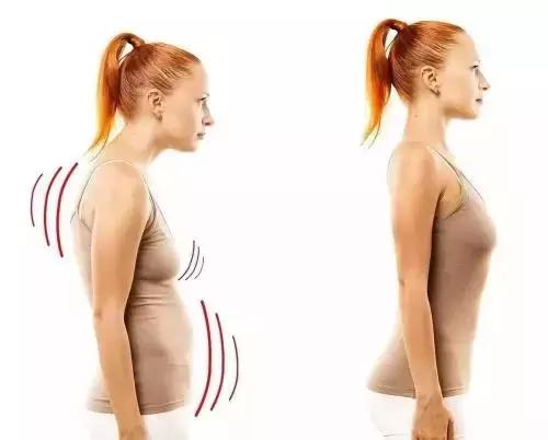 驼背怎么矫正扩胸,矫正胸型防驼背