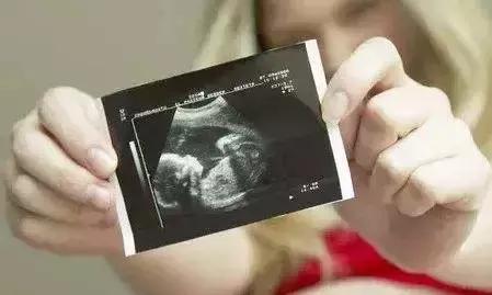 四维彩超预约了还要排队叫号吗,做四维什么时候预约合适