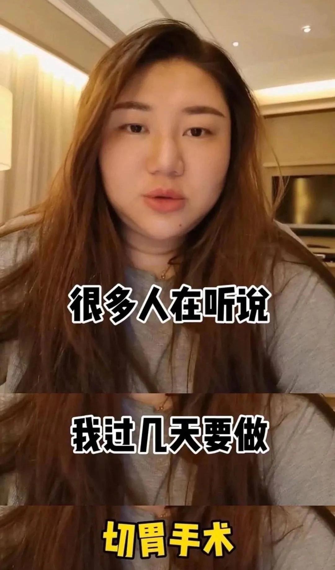 杨天真切胃后瘦了吗,杨天真做切胃手术