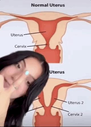 18岁女孩每隔十天又流血,18岁女孩一个月月经来二次