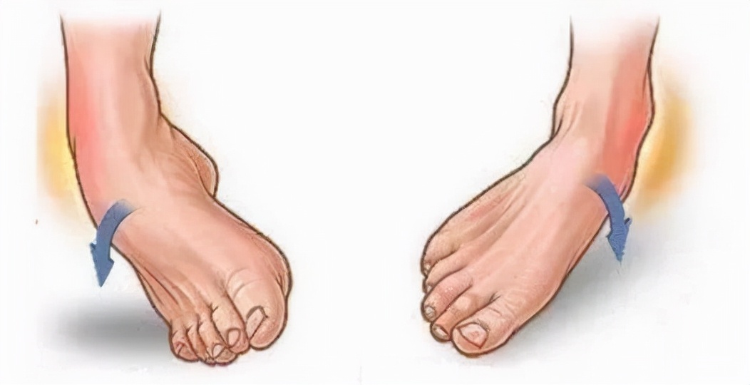 伤筋没伤骨可以评残吗,伤筋没肿就是疼怎么回事