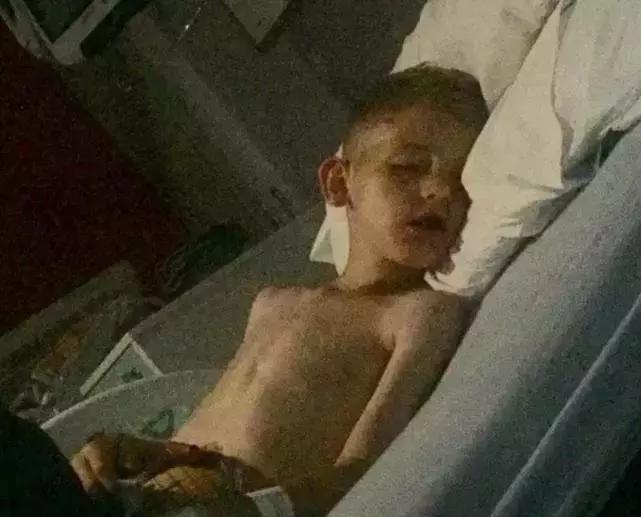 儿童舌头被卡饮料瓶,小孩喝水舌头被卡住了