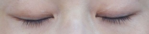 双眼皮怎么才能做到闭眼无痕,双眼皮想要更宽一点