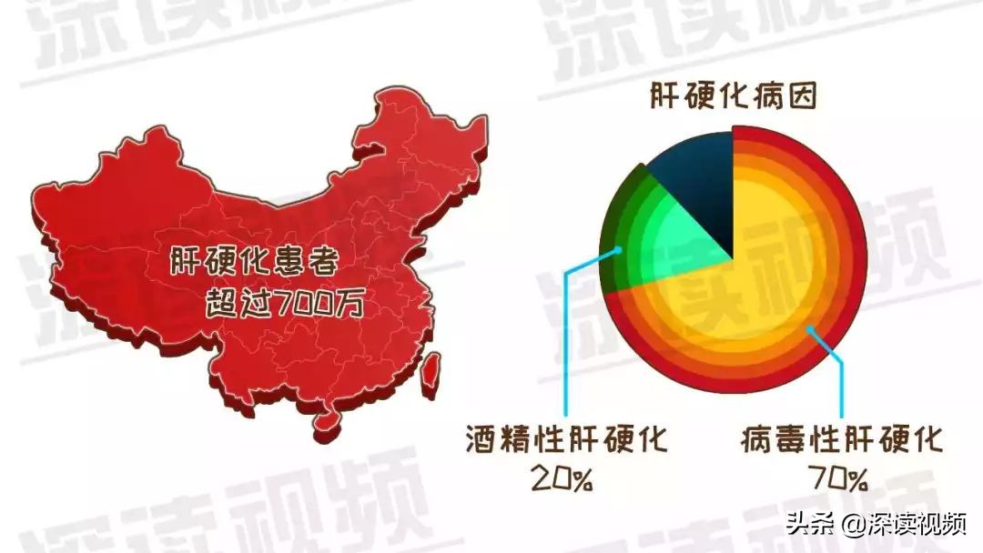 早期肝硬化有什么蛛丝马迹吗,如何判定早期肝硬化和晚期肝硬化