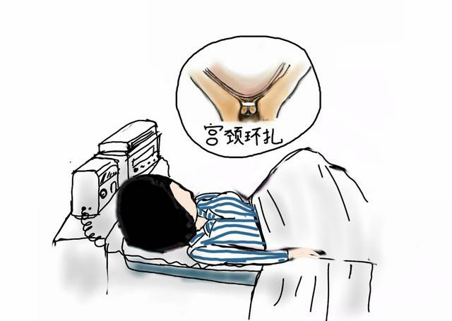 孕妈孕检必须做的,孕妈要做宫颈筛查