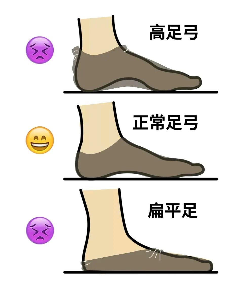 袜子走路老掉有什么妙招,走路掉袜子的科学解决方法