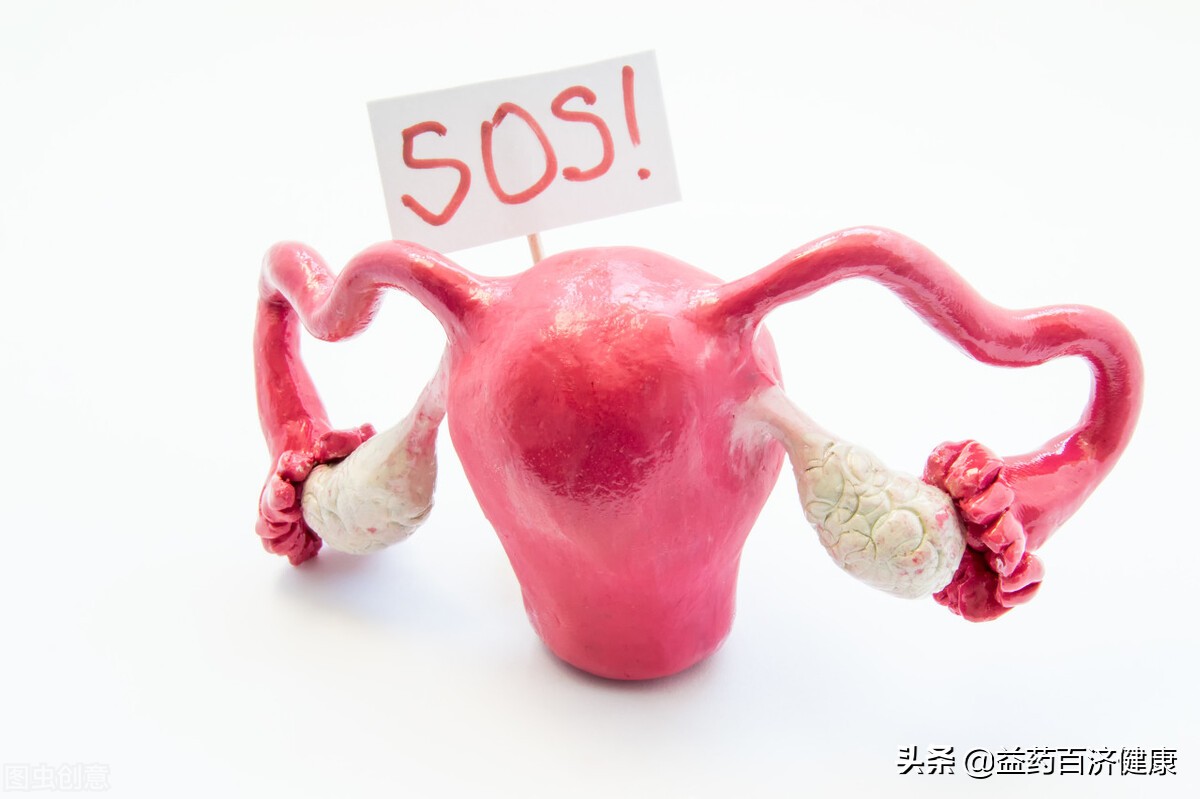 卵巢癌的晚期症状都给你列出来了，赶紧对照看看吧