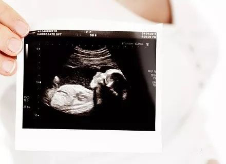 预产期过了还没发动怎么办,预产期过了还没生过怎么办