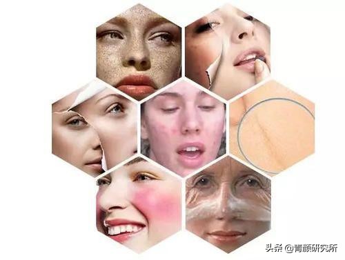 修复角质层薄红血丝敏感肌擦什么,角质层薄红血丝敏感肌肤用什么药