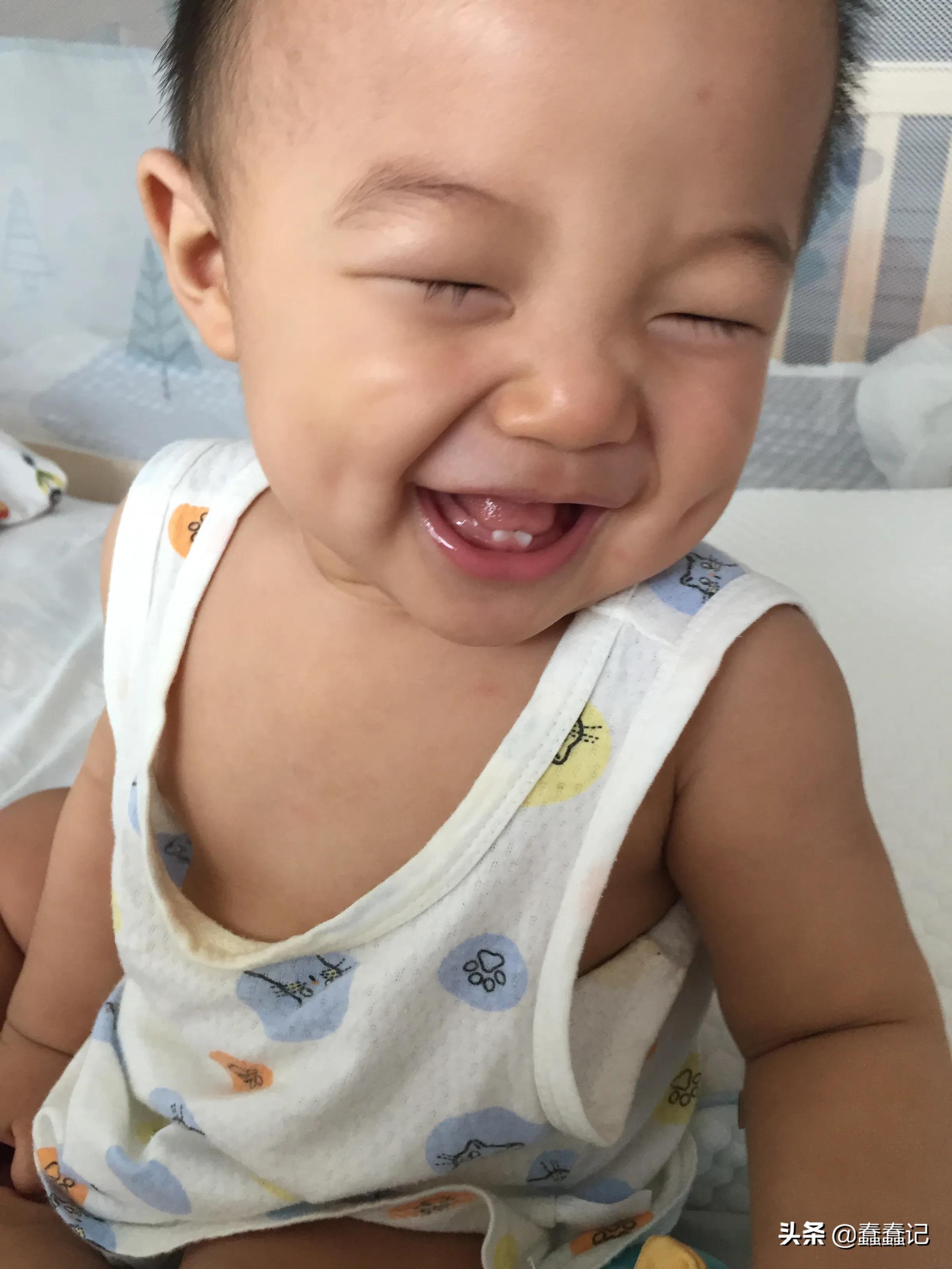 七个月检查宝宝头偏小,7个月婴儿头围40做核磁共振正常