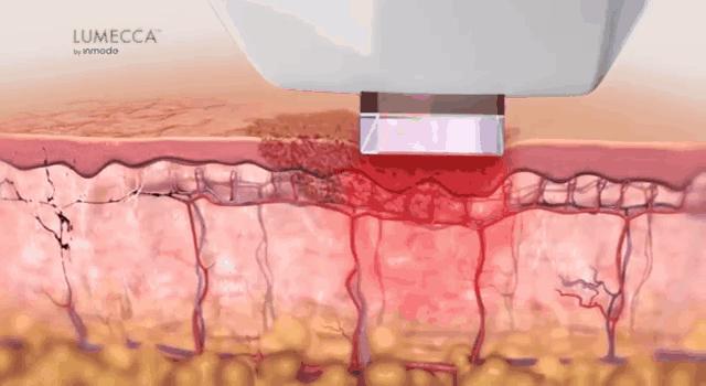 医美皮肤科医生怎么学,皮肤科医生介绍医美项目