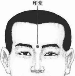 道士说印堂发黑有血光之灾的视频,印堂发黑是有血光之灾吗