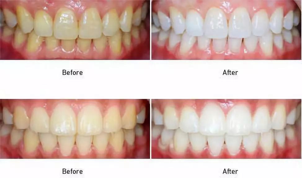 李佳琦给高晓松涂了口红，“美”得不像话？！不过牙齿是真的白