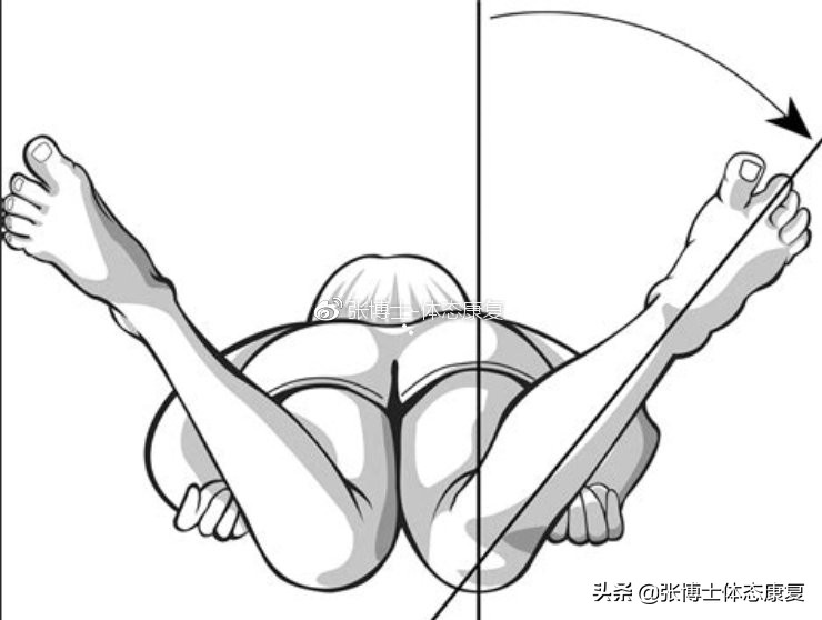 功能训练改善髋关节灵活性,髋关节内旋不足的训练