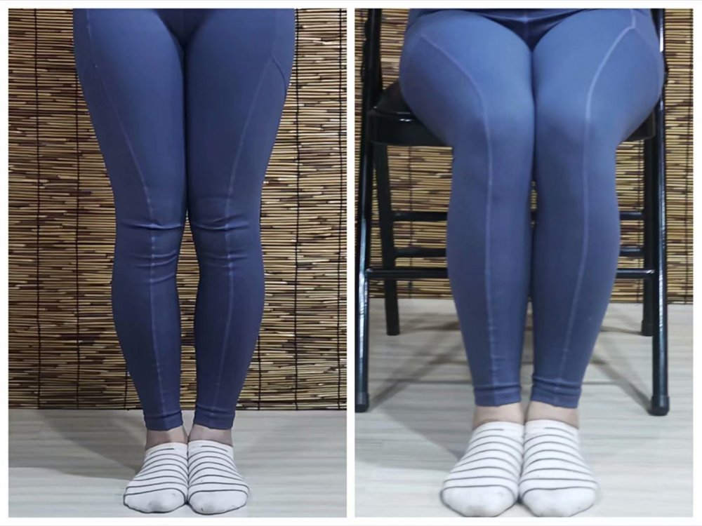 穿纸尿裤对孩子腿型有影响吗,小时候腿不正长大后会矫正吗