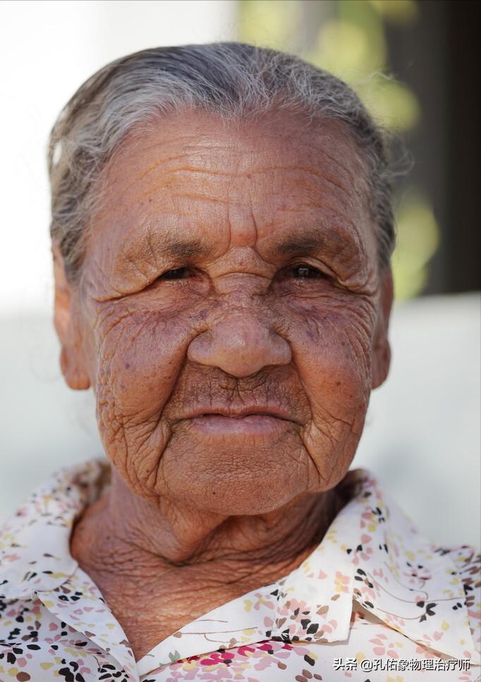 多年的老年斑消除最好的方法,为什么会长老年斑如何可以去除