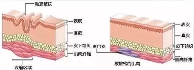 面部抗全面衰强攻略
