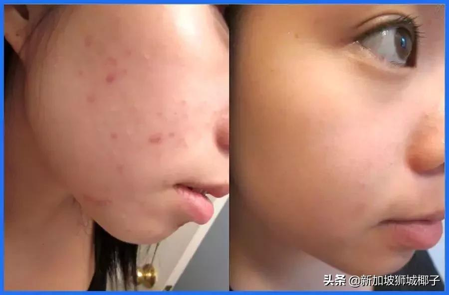 新西兰药妆店必买产品,新加坡日本药妆