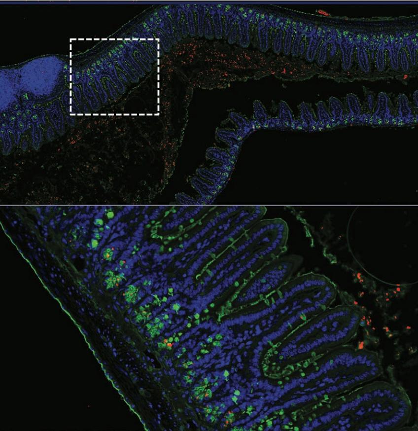 养乐多联手Nature设立全球肠道健康基金,今年花落谁家?