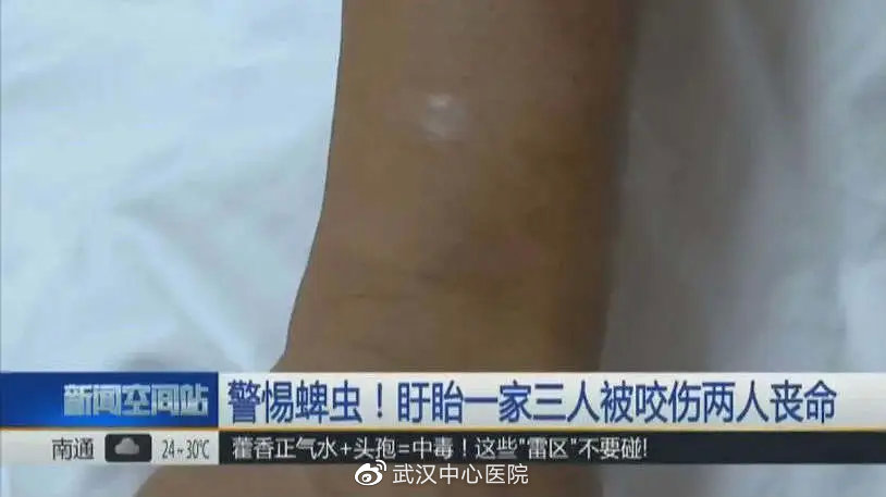 遇到这些虫子千万别拍它,提高警惕遇到这些虫子千万别乱拍