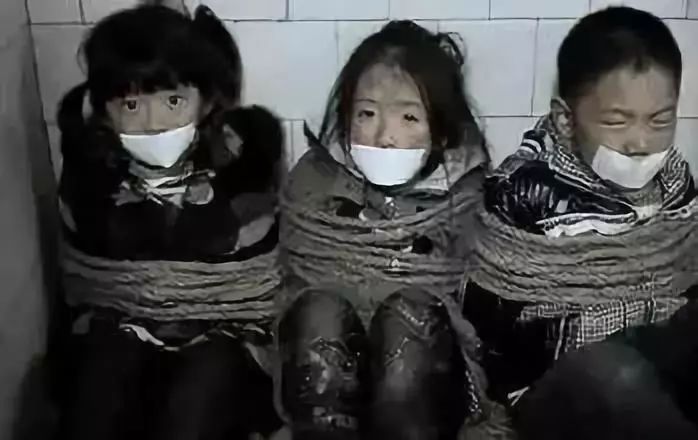 眼球被挖走了还能恢复么,眼球被挖走了还能恢复吗