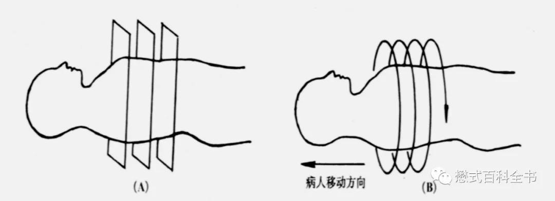 ct排数和层数区别,ct排与层的区别