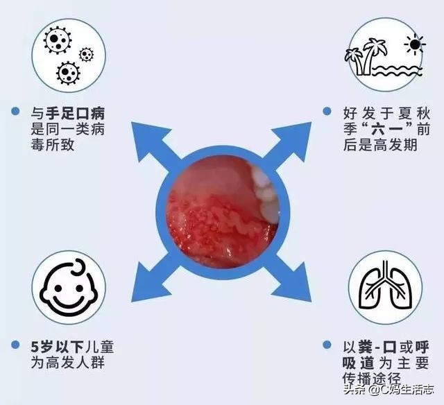 疱疹性咽峡炎恐怖吗,疱疹性咽炎可怕吗