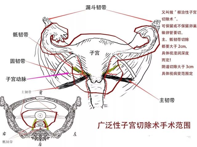 没有了子宫对身体有什么影响,没了子宫会有什么感觉
