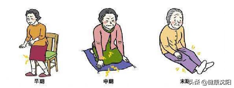 健康科普堂｜【视频】“爱膝”就是爱自己