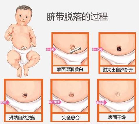 宝宝出生3天脐带流血化脓怎么办,婴儿脐带化脓出血怎么办