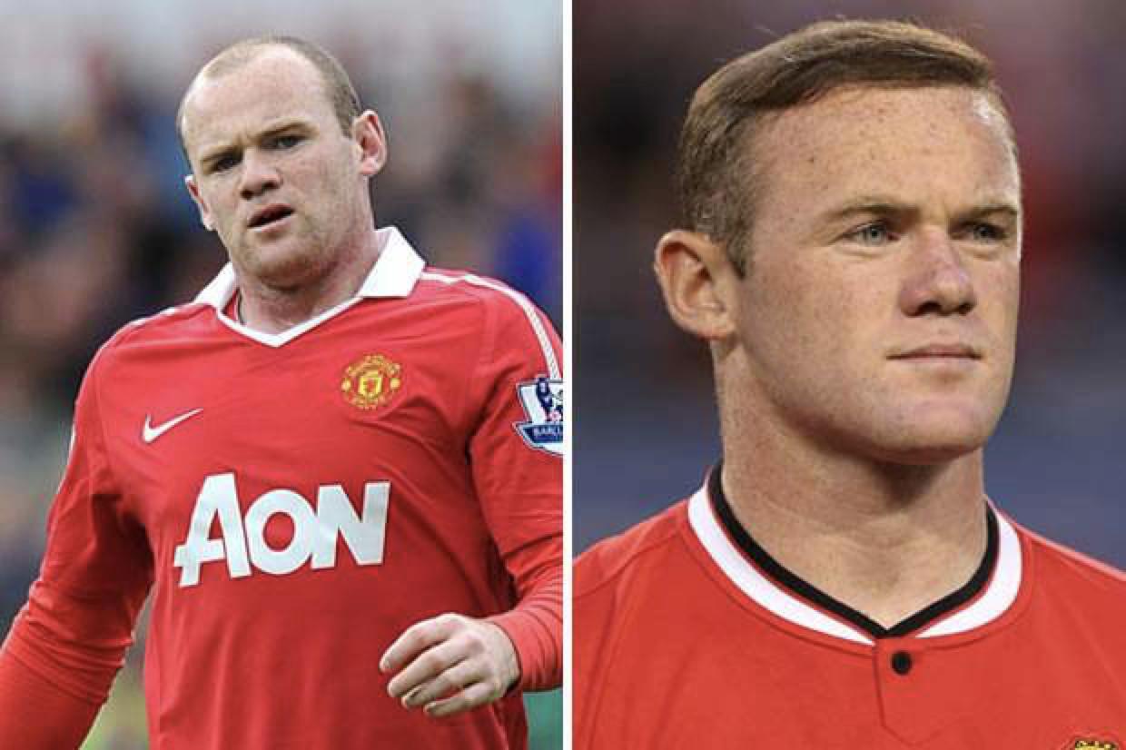 秃如其来的问题青年,突如其来的后果