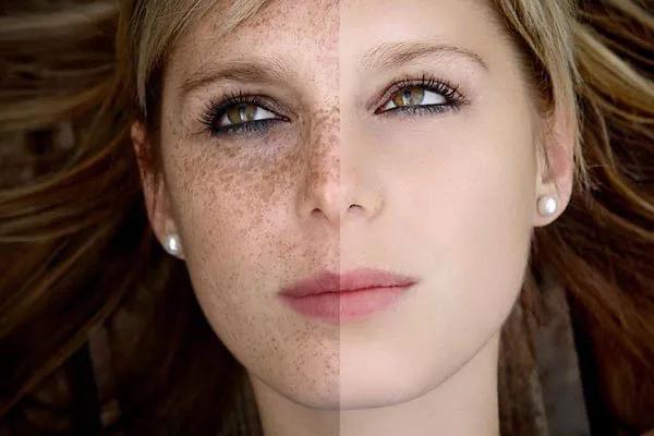 祛斑小妙招,祛斑小妙招短视频