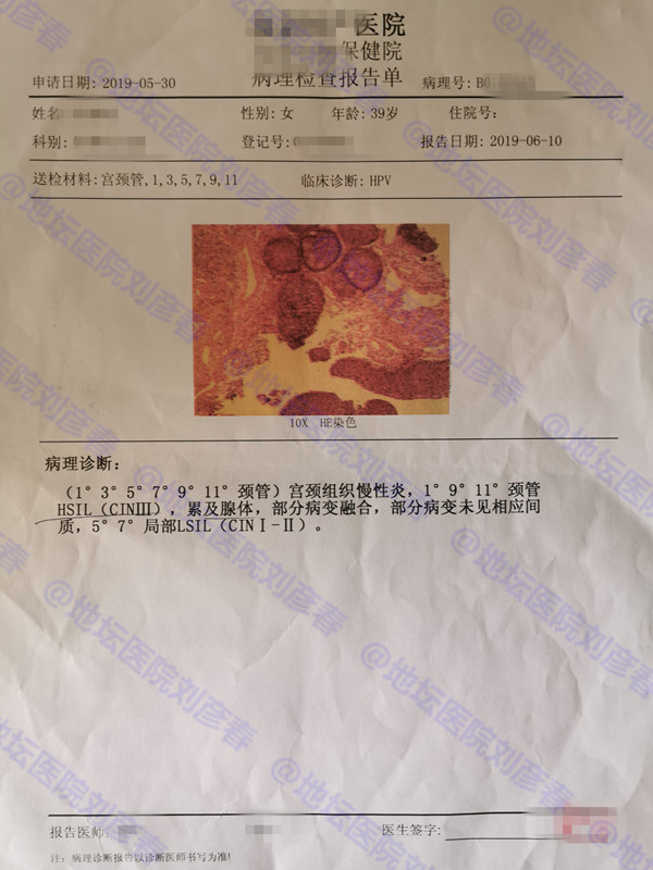 宫颈高级别鳞状上皮内病变cin3,宫颈病变cin3一般能锥切干净吗