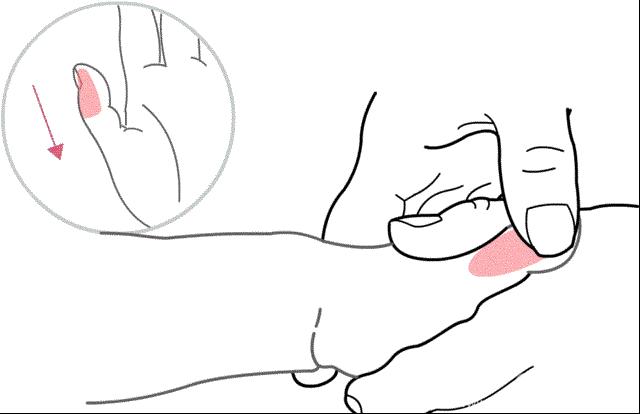 孩子湿疹反反复复，瘙痒难耐，推拿这六个穴位效果好！