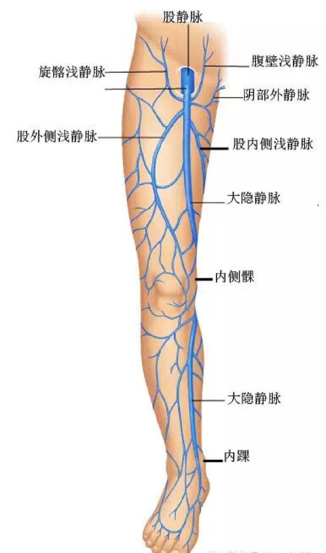 简述大隐静脉曲张治疗方法,大隐静脉曲张的说说