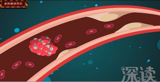 高血压对身体的危害你知道多少,高血压对人体有什么影响和危害