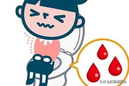 发现男朋友偷偷用卫生巾，要不要跟他分手？