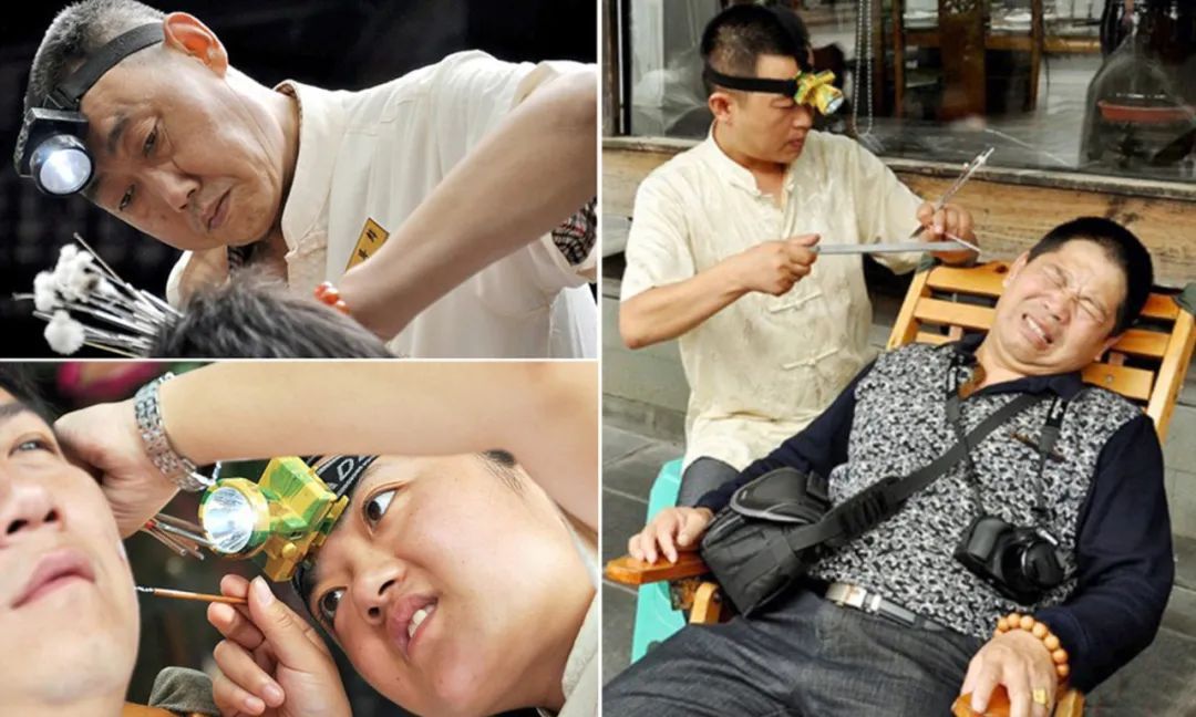 掏耳朵导致耳朵疼最简单止痛方法,棉签掏耳朵的正确方法