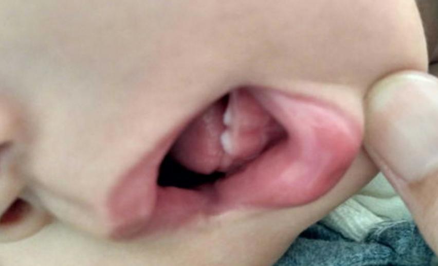 6个月宝宝开始长牙需要注意什么,宝宝六个月长牙了需要注意什么