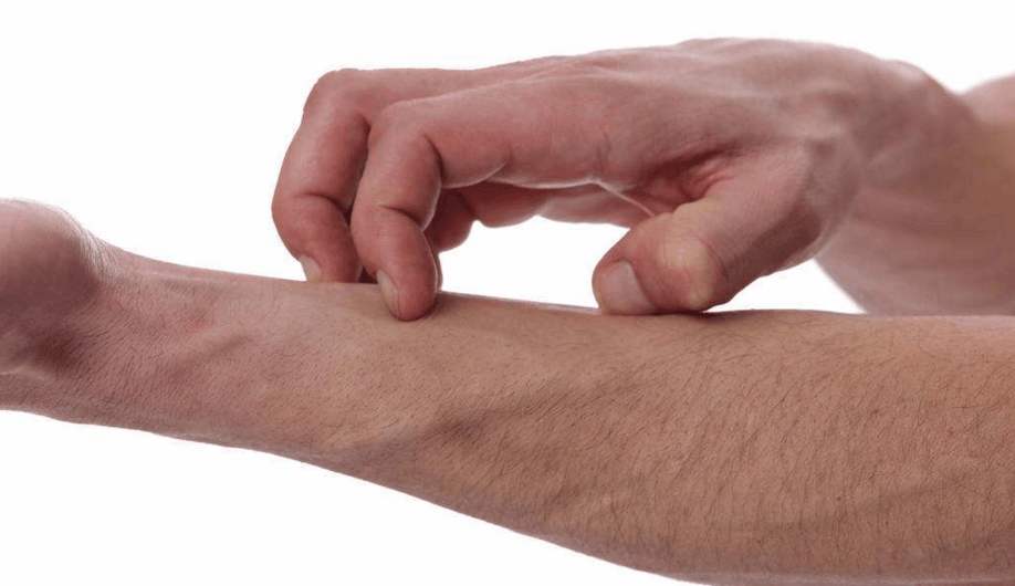 身上反复长痘是怎么回事？学会这几点，对症处理痘痘好得快