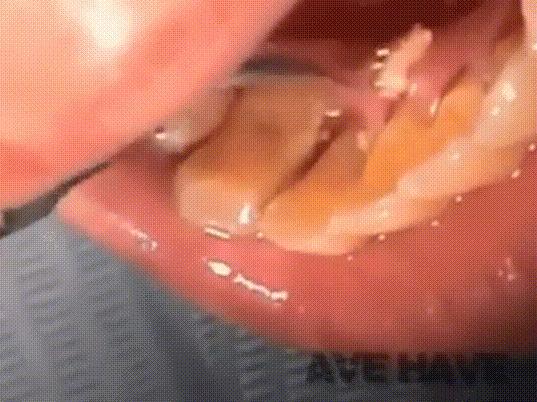 怎么解决戴口罩闷痘,戴口罩闻到自己口气正常吗