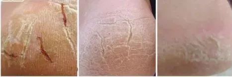 蔡依林的腿值多少钱,蔡依林最迷人的鞋